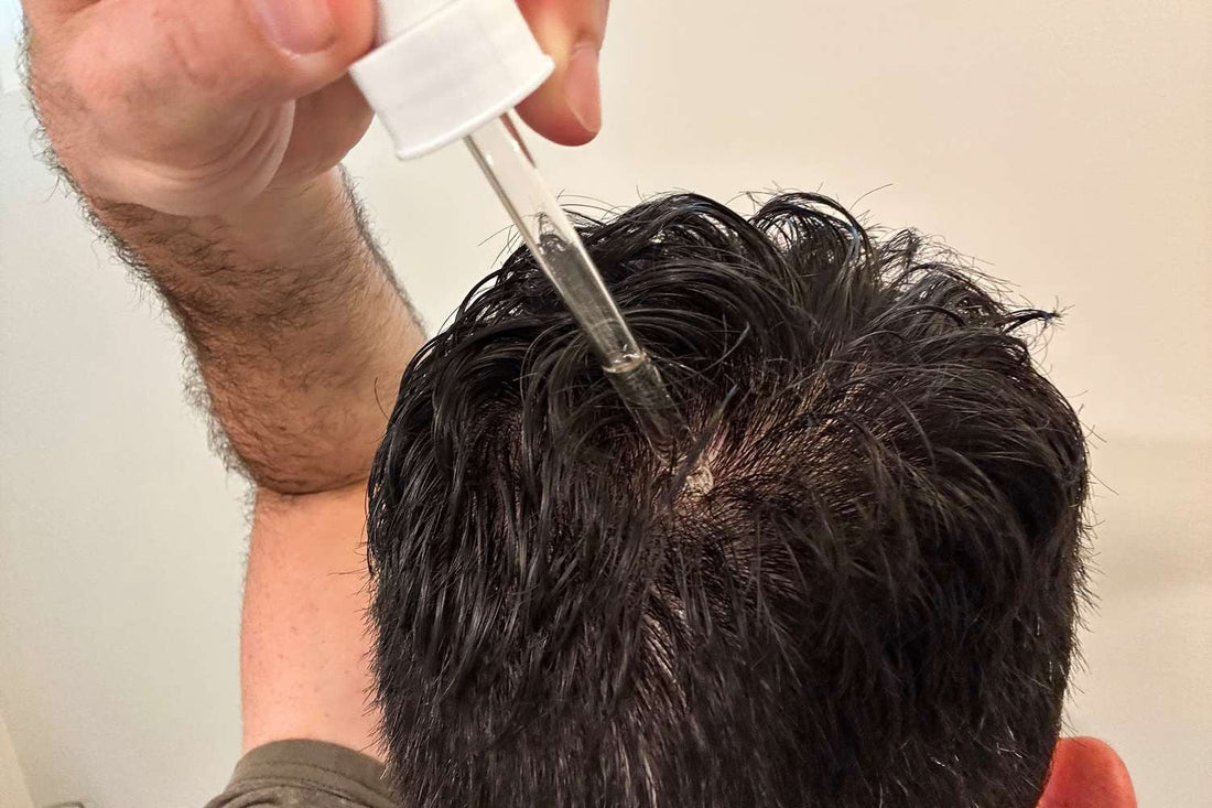 Stunning Oil-Based Hair Growth Serum image