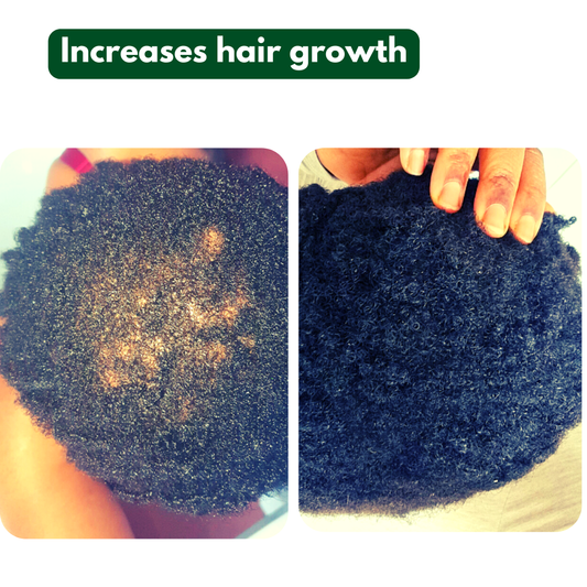 Root2Tip ROOT Energizer Scalp Oil — 100% Natural Alopecia & Hair Loss Treatment